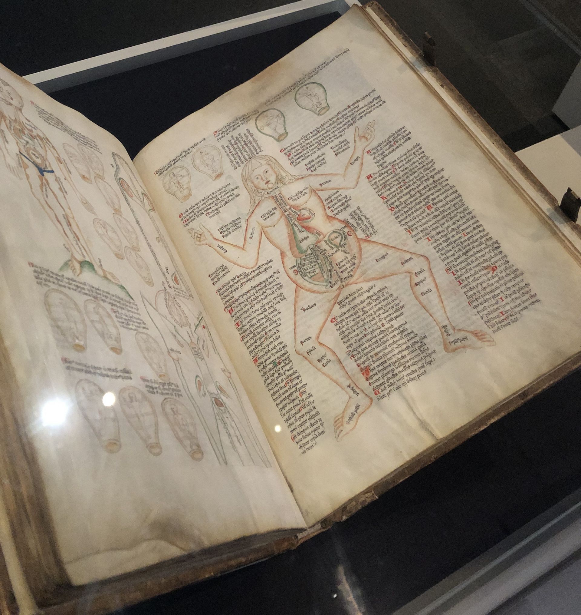 The oldest surviving medieval depiction of the anatomy of a female body The oldest surviving medieval depiction of the anatomy of a female body