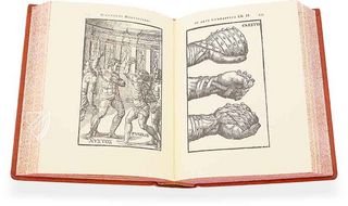 Hieronymus Mercurialis: De Arte Gymnastica – Editions Medicina Rara – Ah VI 1.4 – Universitätsbibliothek Tübingen (Tübingen, Germany)