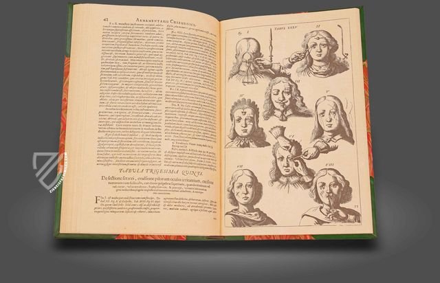 Scultetus: Armamentarium Chirurgicum – Editions Medicina Rara – Leopold-Sophien-Bibliothek (Überlingen, Germany) / Württembergische Landesbibliothek (Stuttgart, Germany) Scultetus: Armamentarium Chirurgicum – Editions Medicina Rara – Leopold-Sophien-Bibliothek (Überlingen, Germany) / Württembergische Landesbibliothek (Stuttgart, Germany)