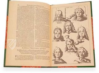 Scultetus: Armamentarium Chirurgicum – Editions Medicina Rara – Leopold-Sophien-Bibliothek (Überlingen, Germany) / Württembergische Landesbibliothek (Stuttgart, Germany)