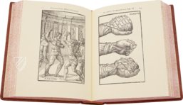 Hieronymus Mercurialis: De Arte Gymnastica – Editions Medicina Rara – Ah VI 1.4 – Universitätsbibliothek Tübingen (Tübingen, Germany)