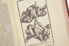 Hieronymus Mercurialis: De Arte Gymnastica – Editions Medicina Rara – Ah VI 1.4 – Universitätsbibliothek Tübingen (Tübingen, Germany)