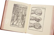 Hieronymus Mercurialis: De Arte Gymnastica – Editions Medicina Rara – Ah VI 1.4 – Universitätsbibliothek Tübingen (Tübingen, Germany)