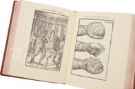 Hieronymus Mercurialis: De Arte Gymnastica – Editions Medicina Rara – Ah VI 1.4 – Universitätsbibliothek Tübingen (Tübingen, Germany)