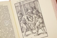 Hieronymus Mercurialis: De Arte Gymnastica – Editions Medicina Rara – Ah VI 1.4 – Universitätsbibliothek Tübingen (Tübingen, Germany)