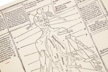 Johannes de Ketham: Fasciculus Medicinae – Editions Medicina Rara – Collection Otto Schäfer (Schweinfurt, Germany)