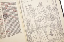 Johannes de Ketham: Fasciculus Medicinae – Editions Medicina Rara – Collection Otto Schäfer (Schweinfurt, Germany)