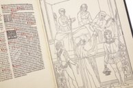 Johannes de Ketham: Fasciculus Medicinae – Editions Medicina Rara – Collection Otto Schäfer (Schweinfurt, Germany)