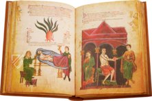 Medicina Antiqua – Club du Livre – Cod. Vindob. 93 – Österreichische Nationalbibliothek (Vienna, Austria)