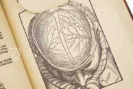 Ophthalmodouleia - Augendienst – Editions Medicina Rara – 38.1.1 Phys. 2° – Herzog August Bibliothek (Wolfenbüttel, Germany)