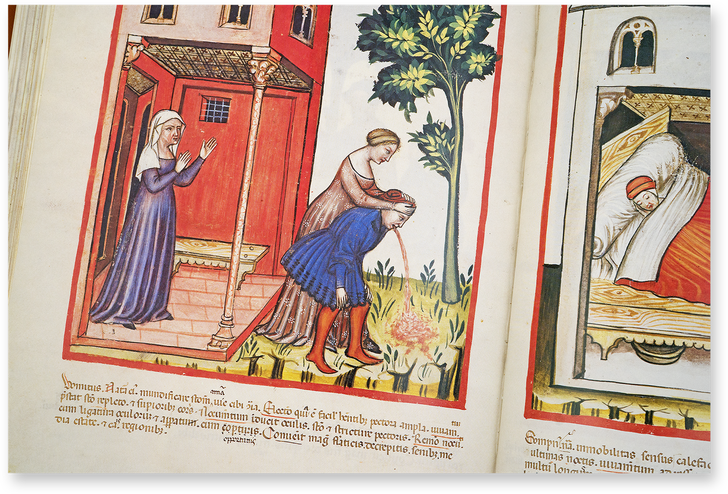 Vomiting (vomitus) and sleep (sompnus) in the Tacuinum Sanitatis in Medicina Vomiting (vomitus) and sleep (sompnus) in the Tacuinum Sanitatis in Medicina